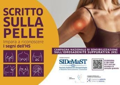 Idrosadenite suppurativa, al via campagna di sensibilizzazione 'Scritto sulla pelle' Idrosadenite suppurativa, al via campagna di sensibilizzazione 'Scritto sulla pelle'