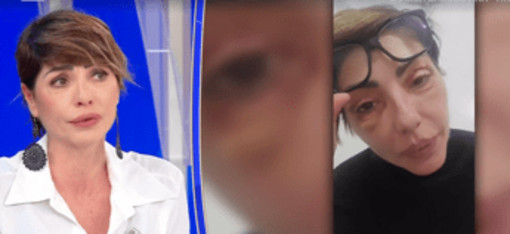 Ilaria Galassi, insulti social per i ritocchi estetici: "Offese anche sui miei figli" Ilaria Galassi, insulti social per i ritocchi estetici: "Offese anche sui miei figli"