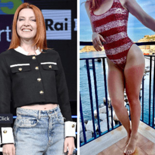 Dalla chioma alle gambe, Noemi ironizza sulla scottatura: &quot;Mai senza crema&quot;