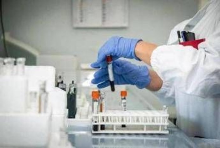 Miastenia gravis, al via studio su qualità di vita e impatto socio-sanitario Miastenia gravis, al via studio su qualità di vita e impatto socio-sanitario