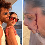 Can Yaman, la fidanzata Sara Bluma denuncia le violenze dell'ex. L'attore: &quot;Ti amo&quot;