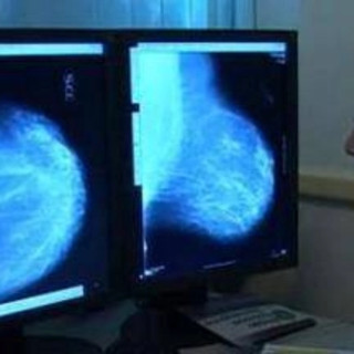Donne operate per tumore al seno, 70% paga cure e 30% teme per il lavoro
