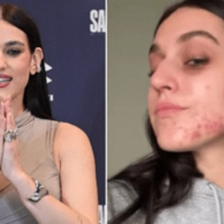 Gaia senza filtri, mostra l'acne sul viso: &quot;Ho pensato di nascondermi, voglio normalizzare&quot;