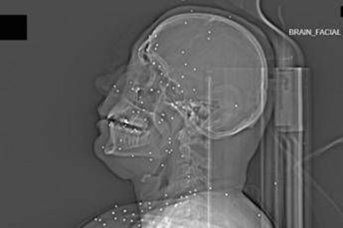 L'inchiesta horror sulle violenze iraniane: 'Manifestanti uccisi e colpiti nelle parti vitali'