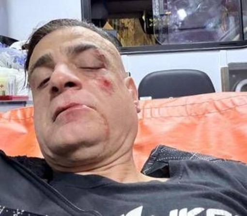 Cicalone, lo youtuber aggredito in metro a Roma: "Infami veri" Cicalone, lo youtuber aggredito in metro a Roma: "Infami veri"