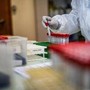Covid, variante LP 8.1: ecco perché preoccupa, identikit e sintomi