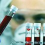 Tumori, Ue approva terapia per adulti con leucemia linfatica cronica refrattaria