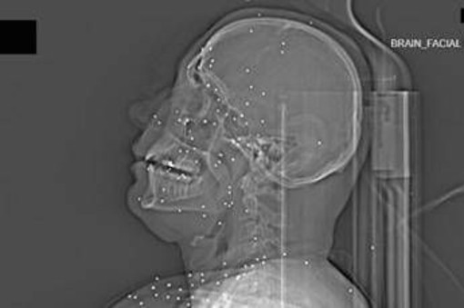 L'inchiesta horror sulle violenze iraniane: 'Manifestanti uccisi e colpiti nelle parti vitali'